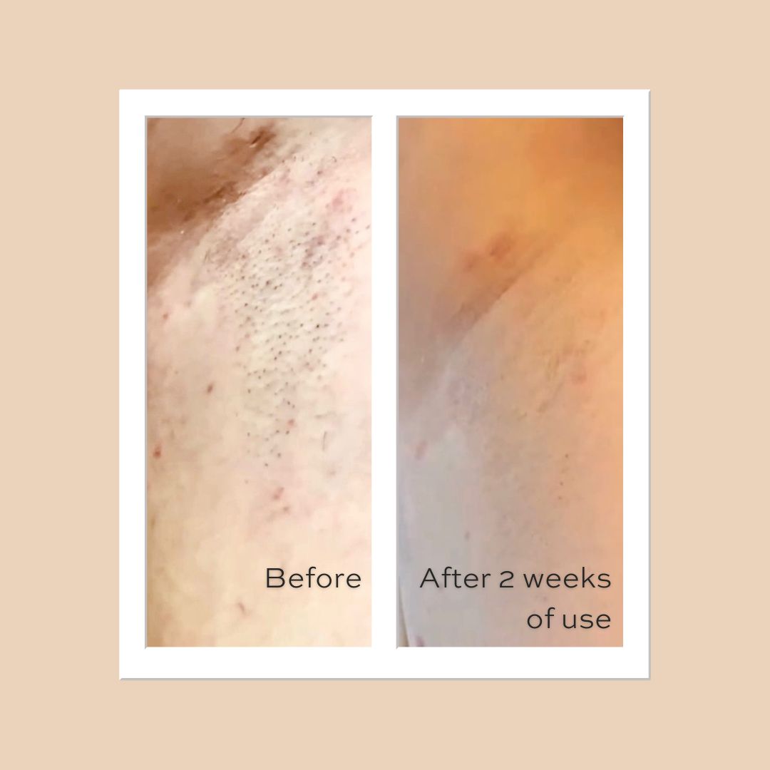 Two-Month 3-Step Private Kit